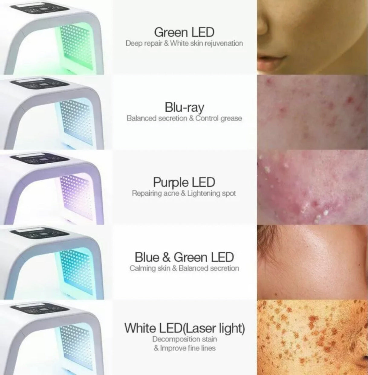 Panel U de rejuvenecimiento fotográfico